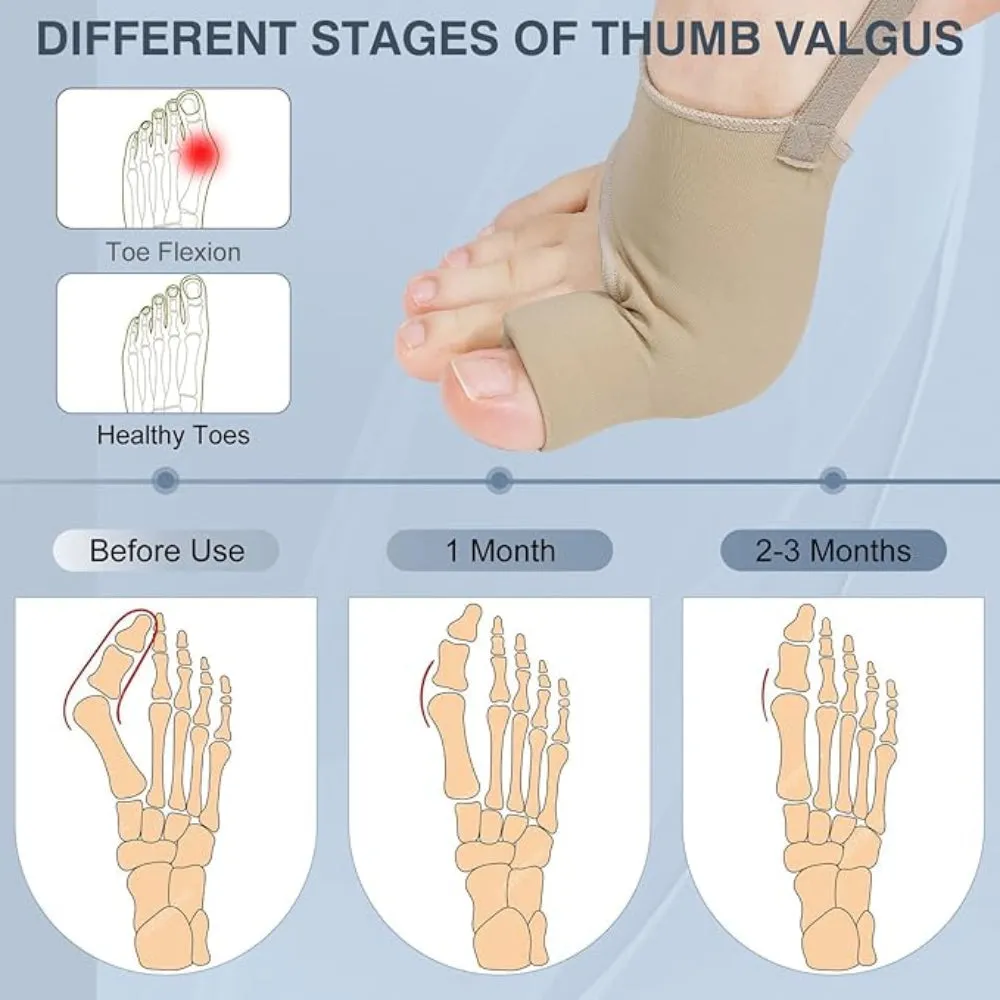 Orthopedic Toe Straightener Bunion Sleeve Socks For Relief And Alignment